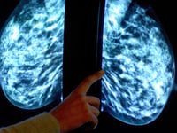 More than 10,000 Herefordshire women miss “vital” cancer screenings