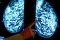 More than 10,000 Herefordshire women miss “vital” cancer screenings