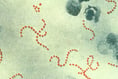 Health chiefs reassure parents in Wales over Strep A concerns