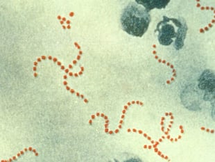 Health chiefs reassure parents in Wales over Strep A concerns