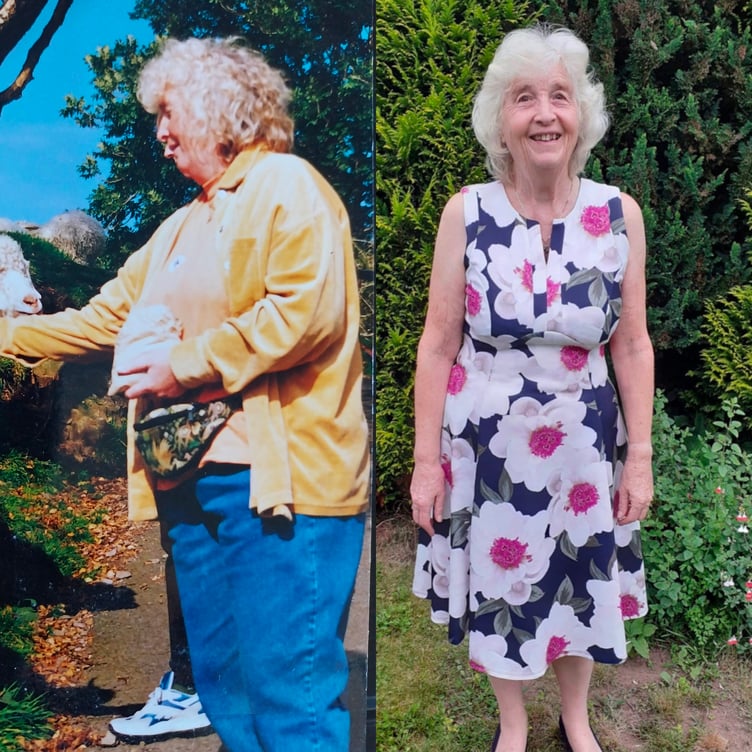 Marion Rainthorpe before and after